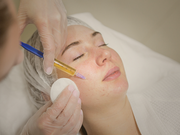 Prp Skin Rejuvenation Treatment Orllando- A Natural Way to Rejuvenate Your Skin