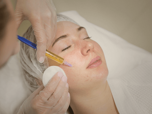 Prp Skin Rejuvenation Treatment Orllando- A Natural Way to Rejuvenate Your Skin