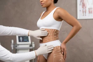 Body sculpting treatment debunking common myths in Florida