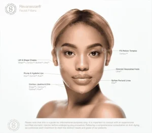Woman showing rejuvenated skin after facial filler treatment at Enfield Royal Medspa Viera FL.