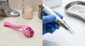 A split image contrasts a risky at-home derma roller with a professional microneedling pen from Enfield Royal Medspa, addressing the DIY microneedling trend. Our clinical treatment uses sterile, single-use tips to safely stimulate collagen and improve skin texture without tearing. Elevate your skin's health.