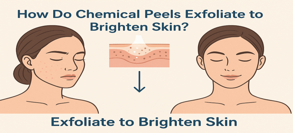 Illustration showing how chemical peels exfoliate and brighten the skin at Enfield Royal Med Spa