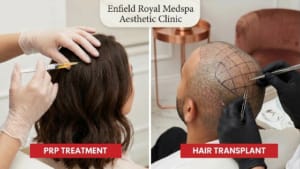 A side-by-side comparison graphic showing the process of a PRP injection versus a surgical hair transplant procedure.