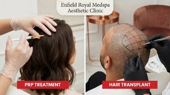 A side-by-side comparison graphic showing the process of a PRP injection versus a surgical hair transplant procedure.