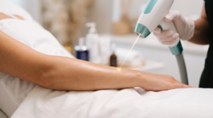 A professional aesthetician in gloves using a handheld laser device to remove hair from a client's forearm in a clean clinic setting in Enfield Royal Clinic.